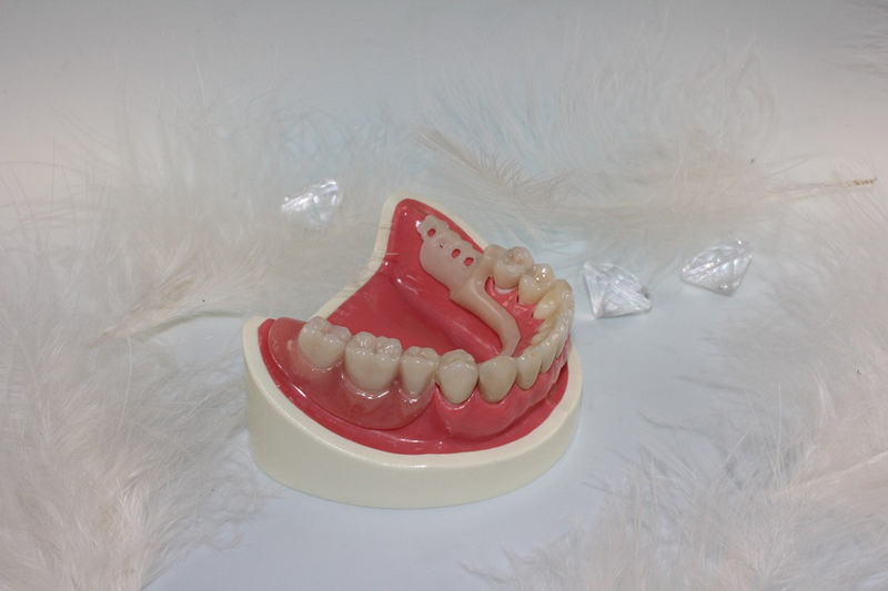 Illustration for article titled An Attractive Grin Can be Acquired After Some Effort